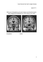 Kutatási anyagok 'Schizophrenia', 6.                