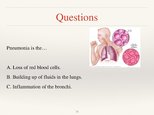 Prezentációk 'Respiratory System', 13.                
