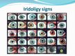Prezentációk 'Iridology', 8.                