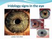 Prezentációk 'Iridology', 9.                