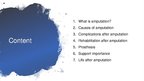 Prezentációk 'Rehabilitation after Amputation', 2.                