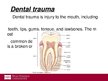 Prezentációk 'Dental Trauma', 4.                
