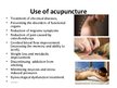 Prezentációk 'Acupuncture', 5.                