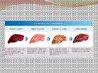Prezentációk 'Liver - Anatomy and Functions', 12.                