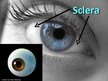 Prezentációk 'Anatomy of Eye', 5.                
