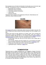 Összefoglalók, jegyzetek 'Acne Vulgaris', 5.                