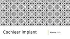 Prezentációk 'Cochlear Implant', 1.                