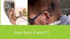 Prezentációk 'Cochlear Implant', 10.                