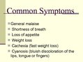 Prezentációk 'Diseases of the Respiratory System', 5.                