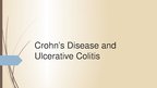 Prezentációk 'Crohn's Disease', 1.                
