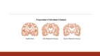 Prezentációk 'Alzheimer Disease', 3.                