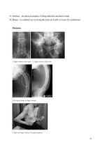 Kutatási anyagok 'Paget`s Disease of Bone', 12.                