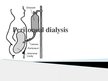 Prezentációk 'Peritoneal Dialysis', 1.                