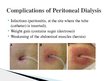 Prezentációk 'Peritoneal Dialysis', 13.                