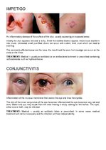 Összefoglalók, jegyzetek 'Bacterial Infection', 2.                