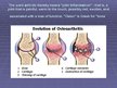 Prezentációk 'Osteoarthritis', 2.                