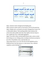 Összefoglalók, jegyzetek 'Clotting Blood Disorders', 4.                