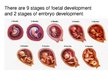 Prezentációk 'Foetal Development', 3.                